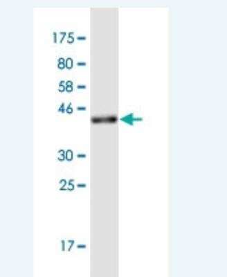 Western Blot: Cancer Antigen 1 Antibody (3H8) [H00285782-M01-100ug]