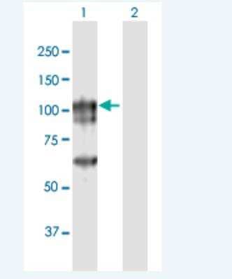 Western Blot: Cancer Antigen 1 Antibody [H00285782-B01P-50ug]