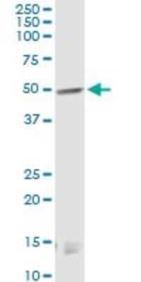 Western Blot: Cannabinoid R1/CB1/CNR1 Antibody (2F9) [H00001268-M01]