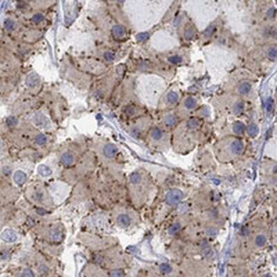 Immunohistochemistry-Paraffin: Cannabinoid R1/CB1/CNR1 Antibody [NBP3-17650]