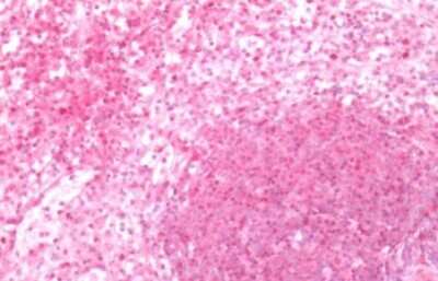 Immunohistochemistry-Paraffin: Cannabinoid R1/CB1/CNR1 Antibody - BSA Free [NLS31]