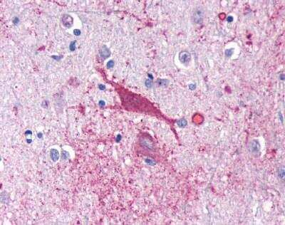 Immunohistochemistry-Paraffin: Cannabinoid R1/CB1/CNR1 Antibody - BSA Free [NLS32]