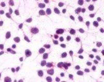 Immunohistochemistry-Paraffin: Cannabinoid R1/CB1/CNR1 Antibody - BSA Free [NLS32]