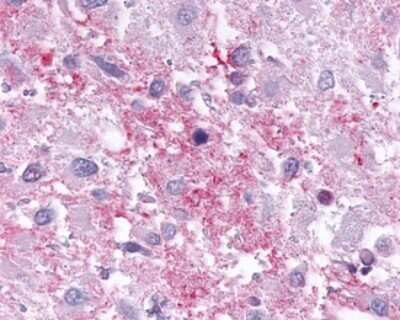 Immunohistochemistry-Paraffin: Cannabinoid R1/CB1/CNR1 Antibody - BSA Free [NLS32]