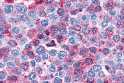 Immunohistochemistry-Paraffin: Cannabinoid R1/CB1/CNR1 Antibody - BSA Free [NLS32]