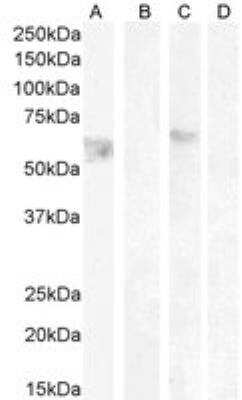 Western Blot: Cannabinoid R1/CB1/CNR1 Antibody [NB100-2427]