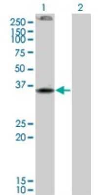 Western Blot: Cannabinoid R2/CB2/CNR2 Antibody (3C7) [H00001269-M01]