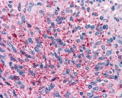 Immunohistochemistry-Paraffin: Cannabinoid R2/CB2/CNR2 Antibody [NLS34]