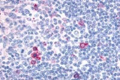 Immunohistochemistry-Paraffin: Cannabinoid R2/CB2/CNR2 Antibody [NLS34]