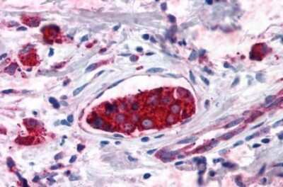 Immunohistochemistry-Paraffin: Cannabinoid R2/CB2/CNR2 Antibody [NLS34]