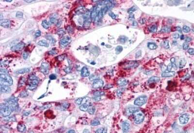 Immunohistochemistry-Paraffin: Cannabinoid R2/CB2/CNR2 Antibody [NLS34]