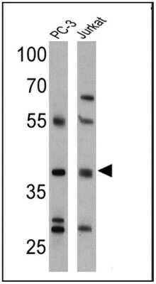 Western Blot: Cannabinoid R2/CB2/CNR2 Antibody [NB300-606]