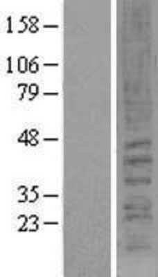 Western Blot: Cannabinoid R2/CB2/CNR2 Overexpression Lysate [NBL1-09328]