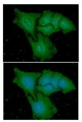 Immunocytochemistry/ Immunofluorescence: CapG Antibody (1D10) - BSA Free [NBP2-59450]