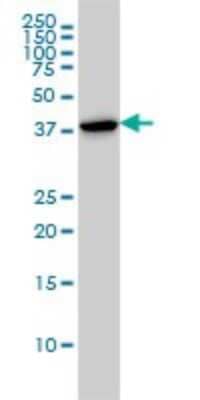 Western Blot: CapG Antibody (1F1) [H00000822-M01]