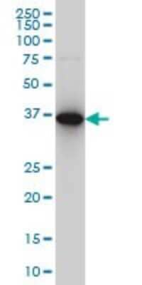 Western Blot: CapG Antibody (6D6) [H00000822-M02]