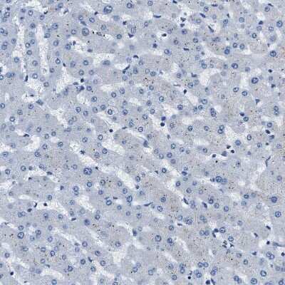 Immunohistochemistry-Paraffin: CapG Antibody [NBP1-90214]