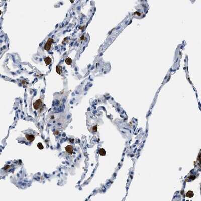 Immunohistochemistry-Paraffin: CapG Antibody [NBP1-90214]