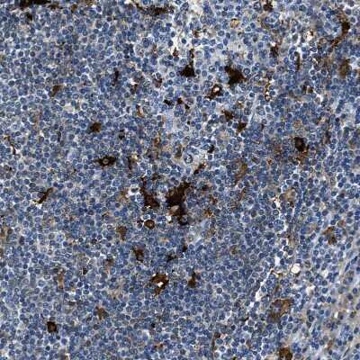Immunohistochemistry-Paraffin: CapG Antibody [NBP1-90214]