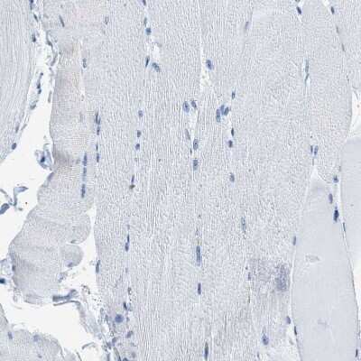 Immunohistochemistry-Paraffin: CapG Antibody [NBP1-90214]