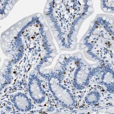 Immunohistochemistry-Paraffin: CapG Antibody [NBP1-90214]
