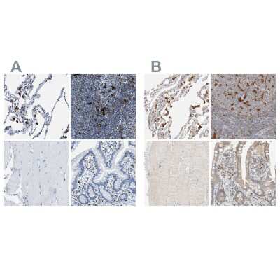 Immunohistochemistry-Paraffin: CapG Antibody [NBP1-90214]