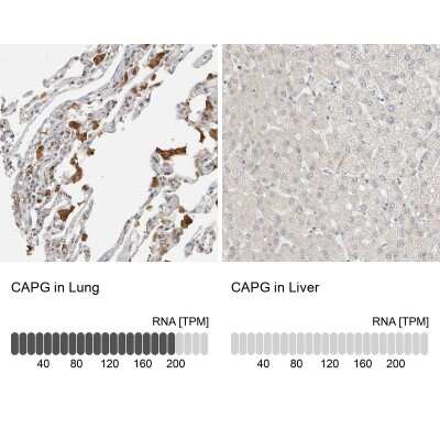 Immunohistochemistry-Paraffin: CapG Antibody [NBP1-90215]