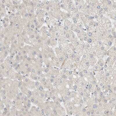 Immunohistochemistry-Paraffin: CapG Antibody [NBP1-90215]