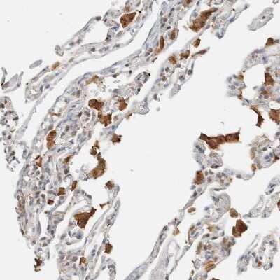 Immunohistochemistry-Paraffin: CapG Antibody [NBP1-90215]