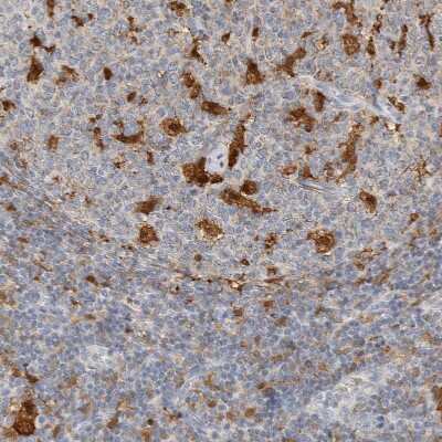 Immunohistochemistry-Paraffin: CapG Antibody [NBP1-90215]