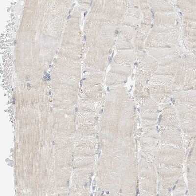 Immunohistochemistry-Paraffin: CapG Antibody [NBP1-90215]