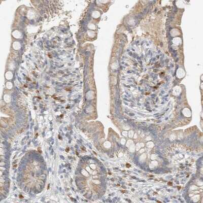 Immunohistochemistry-Paraffin: CapG Antibody [NBP1-90215]