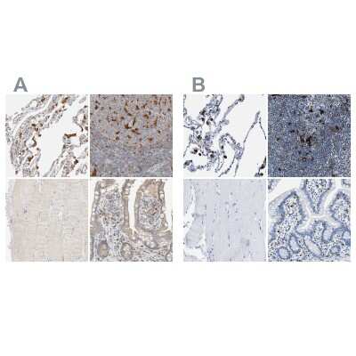 Immunohistochemistry-Paraffin: CapG Antibody [NBP1-90215]