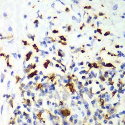 Immunohistochemistry-Paraffin: CapG Antibody - BSA Free [NBP2-92955]