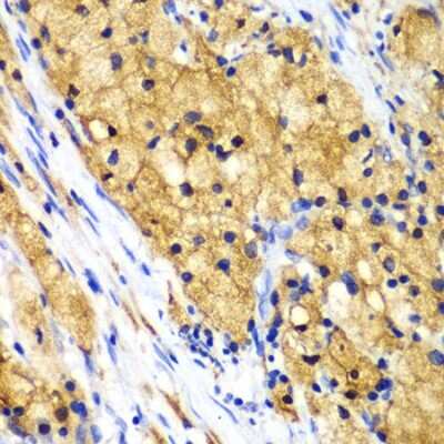 Immunohistochemistry-Paraffin: CapG Antibody - BSA Free [NBP2-92955]