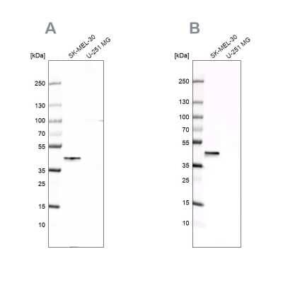 Western Blot: CapG Antibody [NBP1-90213]