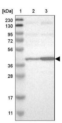 Western Blot: CapG Antibody [NBP1-90215]