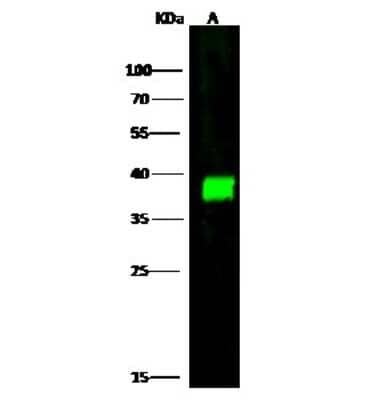 Western Blot: CapG Antibody [NBP3-00258]