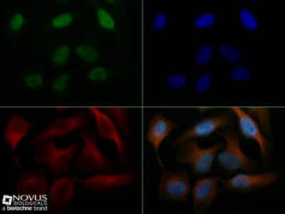 Immunocytochemistry/ Immunofluorescence: Capicua Antibody - BSA Free [NB110-59906]