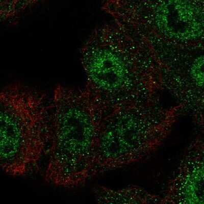 Immunocytochemistry/ Immunofluorescence: Capicua Antibody [NBP2-56342]