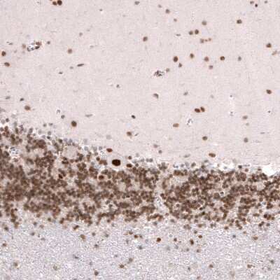 Immunohistochemistry-Paraffin: Capicua Antibody [NBP2-33420]