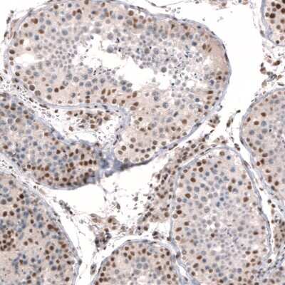 Immunohistochemistry-Paraffin: Capicua Antibody [NBP2-33420]