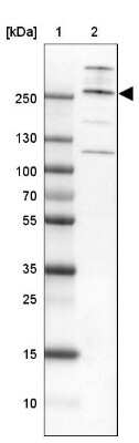 Western Blot: Capicua Antibody [NBP2-33420]
