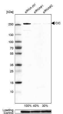 Western Blot: Capicua Antibody [NBP2-33420]