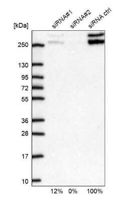 Western Blot: Capicua Antibody [NBP2-33420]