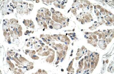 Immunohistochemistry-Paraffin: Carbohydrate Sulfotransferase 1/CHST1/KS6ST Antibody [NBP1-62542]
