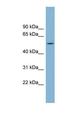 Western Blot: Carbohydrate Sulfotransferase 1/CHST1/KS6ST Antibody [NBP1-62370]