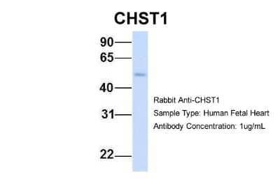 Western Blot: Carbohydrate Sulfotransferase 1/CHST1/KS6ST Antibody [NBP1-62370]