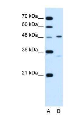 Western Blot: Carbohydrate Sulfotransferase 1/CHST1/KS6ST Antibody [NBP1-62542]