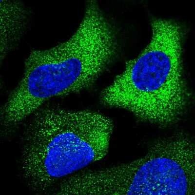 Immunocytochemistry/ Immunofluorescence: Carbohydrate Sulfotransferase 10/CHST10 Antibody [NBP2-58263]